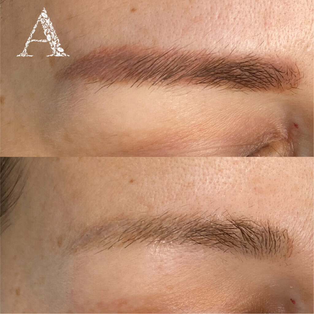 Usuwanie makijażu permanentnego Absolutely Karolina Szczepańska